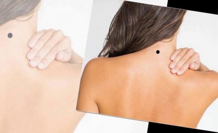 Nốt ruồi trên cổ ở nam giới và nữ giới có ý nghĩa gì? 305199737