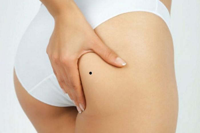 Nốt ruồi ở bộ phận sinh dục nữ có tốt không? 