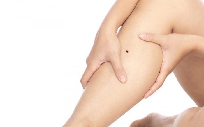 Giải thích ý nghĩa của nốt ruồi trên chân nam giới