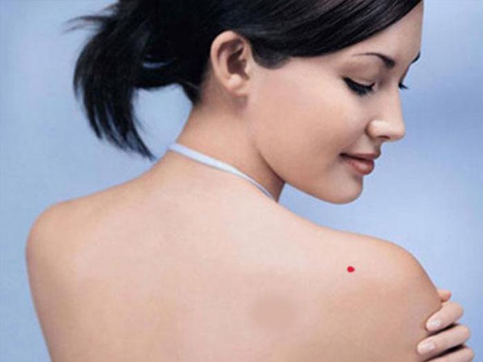 Nốt ruồi trên vai phải có ý nghĩa gì?