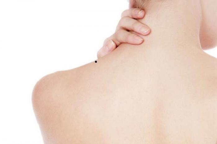 Giải mã ý nghĩa nốt ruồi ở vai trái