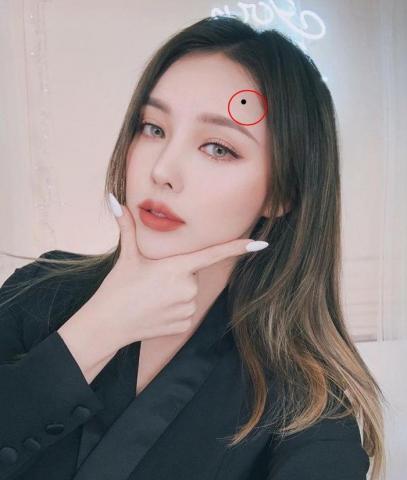 Tiết lộ ý nghĩa nốt ruồi trên trán