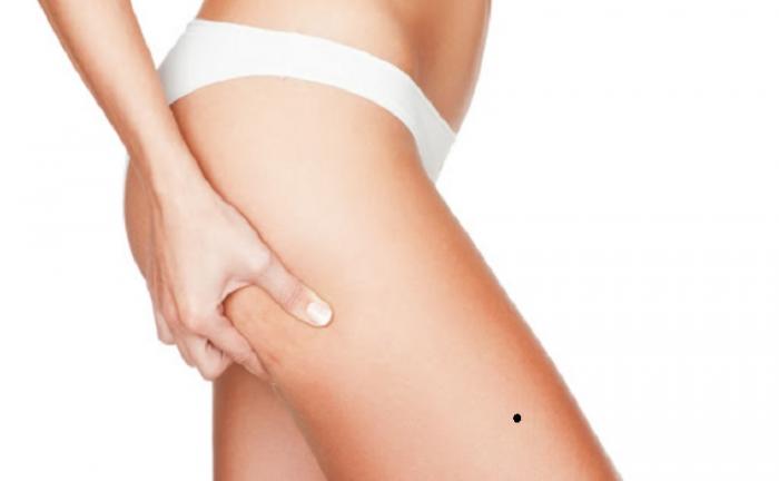 Nốt ruồi trên đùi phải có ý nghĩa gì?