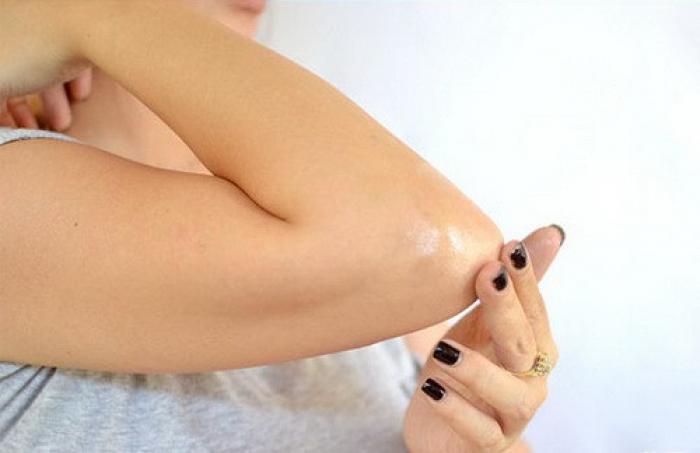 Những người có nốt ruồi ở khuỷu tay trông như thế nào?