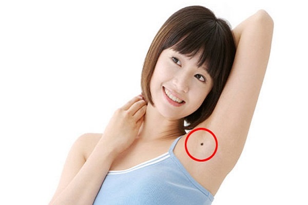 Tiết lộ ý nghĩa nốt ruồi dưới cánh tay