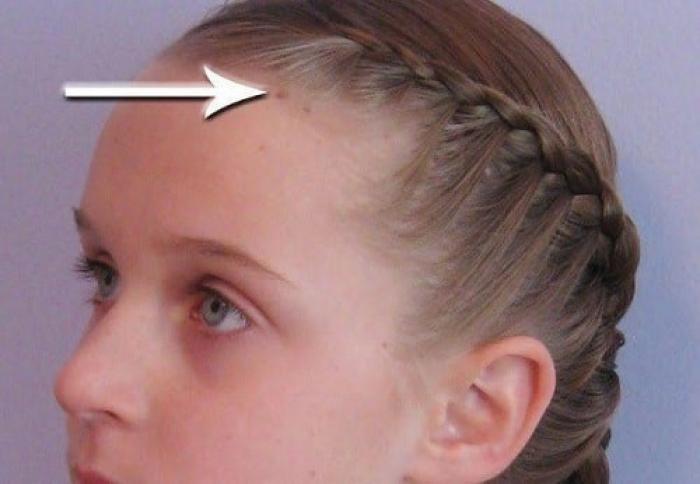 Nốt ruồi ở môi tự nhiên có ý nghĩa gì?