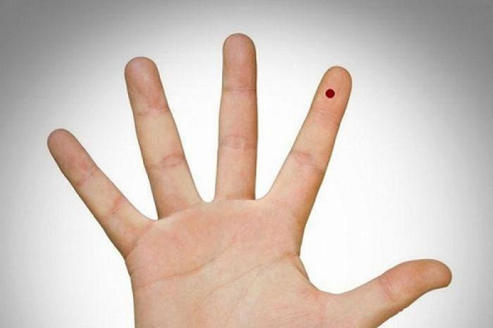 Nốt ruồi ở môi tự nhiên có ý nghĩa gì?