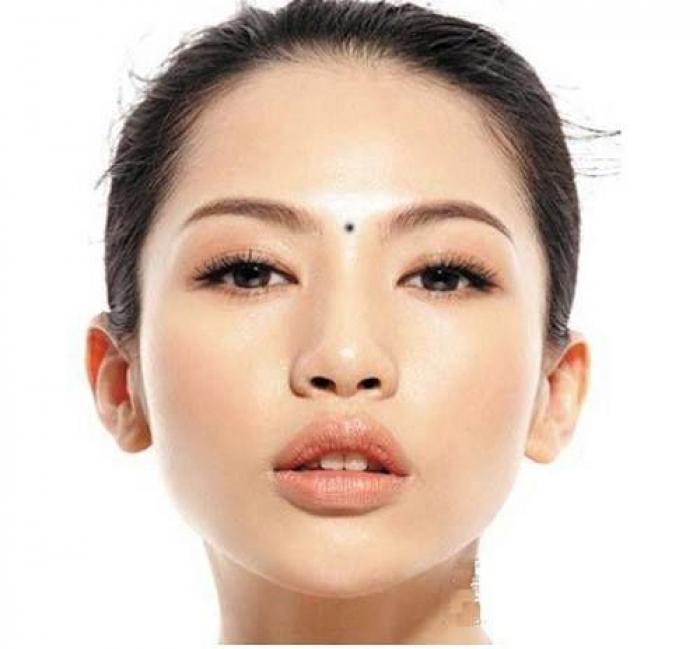 Những vị trí không nên tẩy nốt ruồi trên mặt