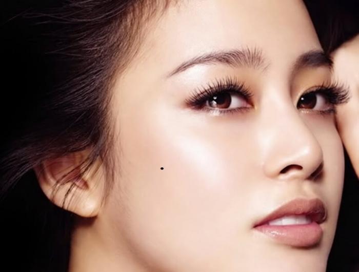 Những vị trí không nên tẩy nốt ruồi trên mặt