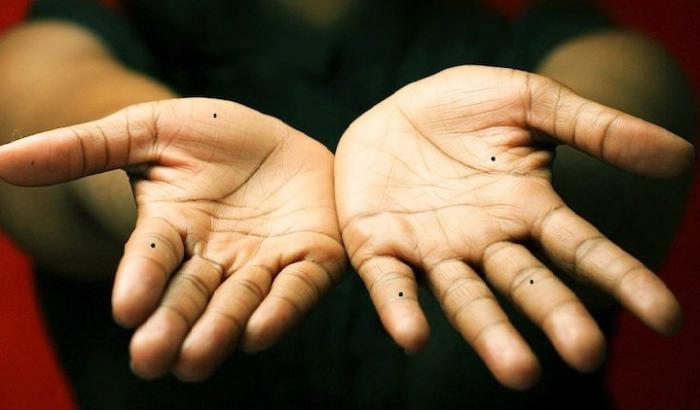 Nốt ruồi ở ngón giữa có ý nghĩa gì?