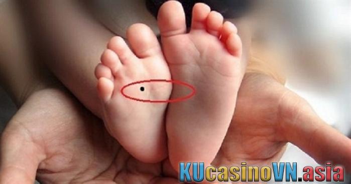 Nốt ruồi ở lòng bàn chân