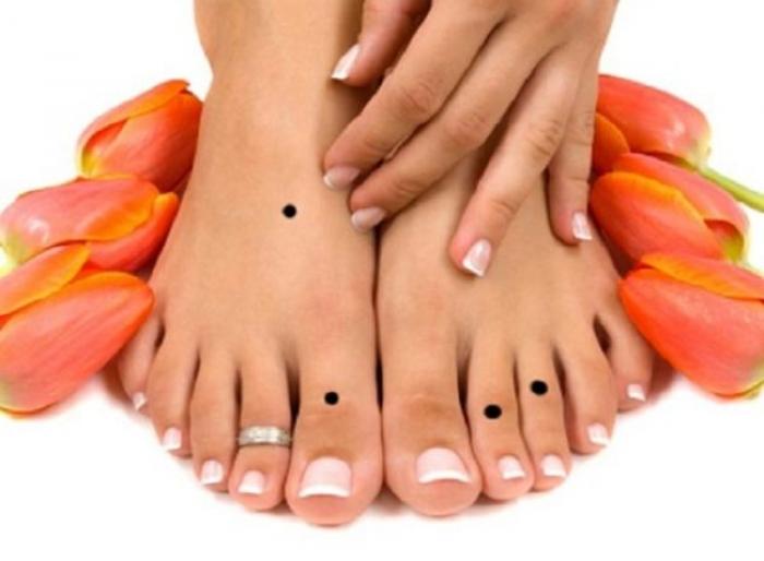 Nốt ruồi ở lòng bàn chân phải có ý nghĩa gì