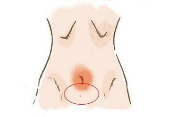 Làm sáng tỏ ý nghĩa của nốt ruồi âm đạo có thể làm bạn ngạc nhiên