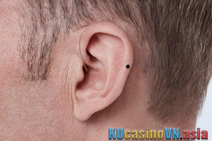 nốt ruồi trên tai đàn ông