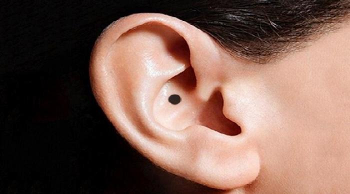 Ý nghĩa nốt ruồi trên tai đàn ông