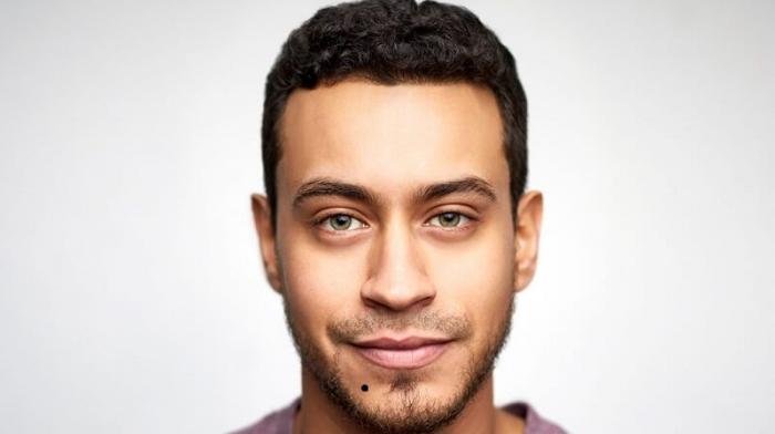 Bật mí ý nghĩa nốt ruồi ở cằm đàn ông