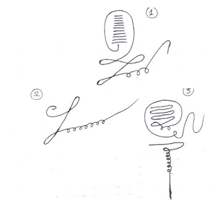 Sức hấp dẫn của sự tầm thường là gì? Lệnh cấm có thể được dỡ bỏ?