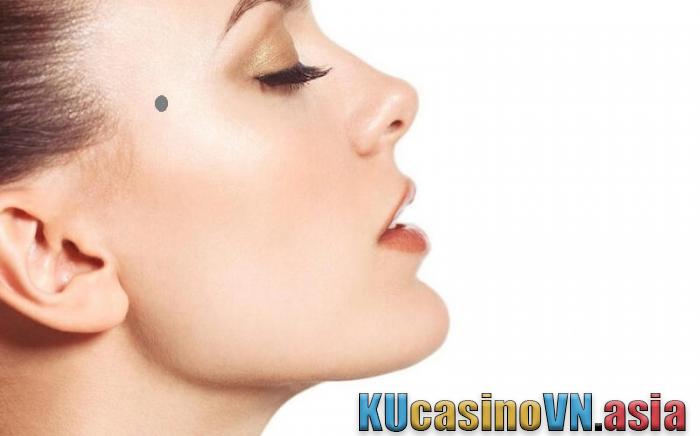 nốt ruồi xuất ngoại